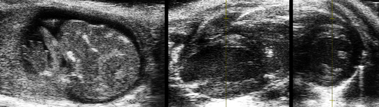 Lab Session C - Ultrasound Imaging: Development, Physiology and disease 